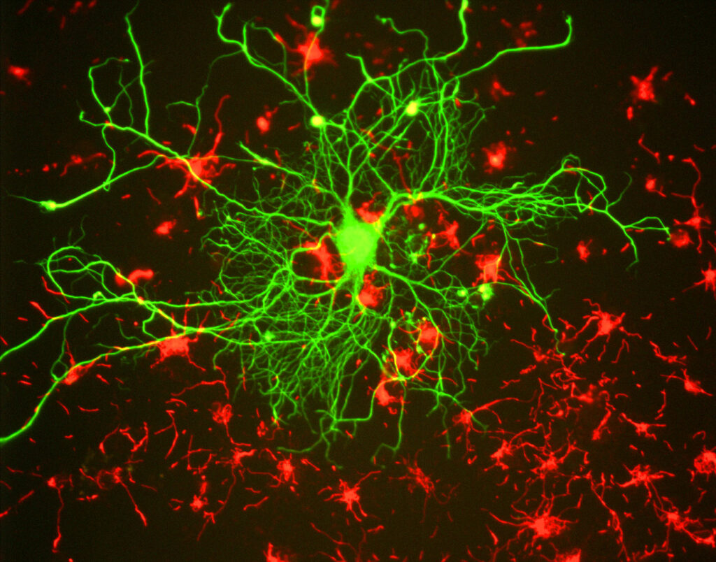 colored neuron in a tissue culture